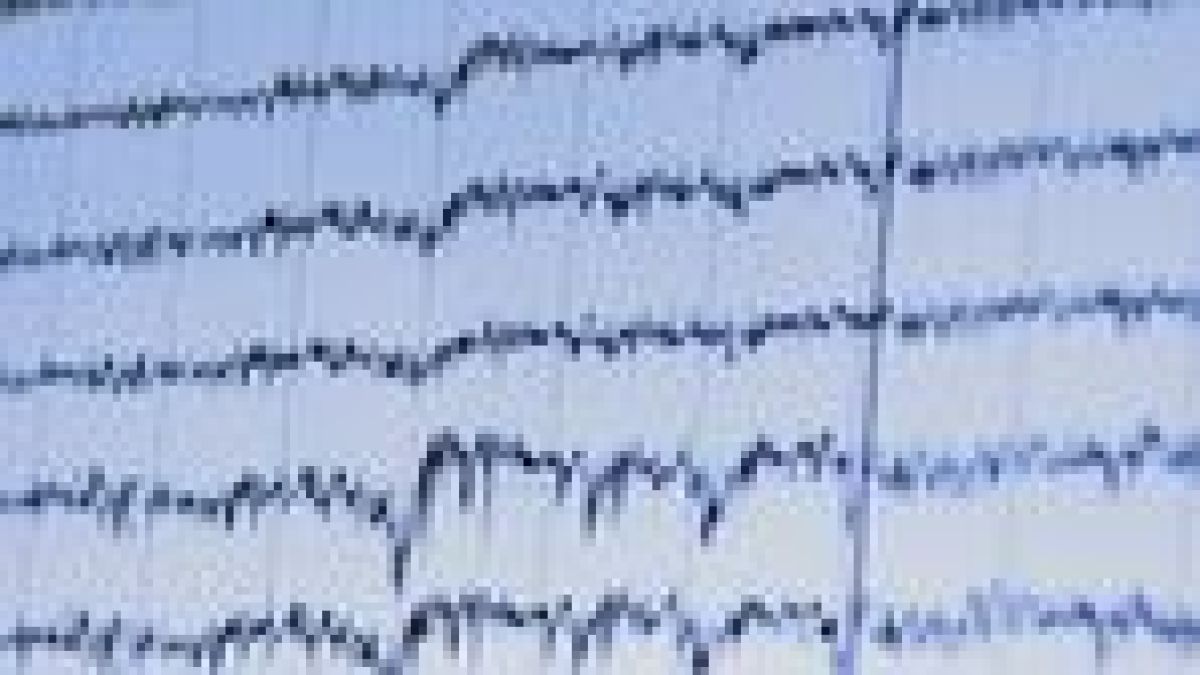 VISP monitors brain waves during sleep to know when to apply a light electrical stimulus to the head.